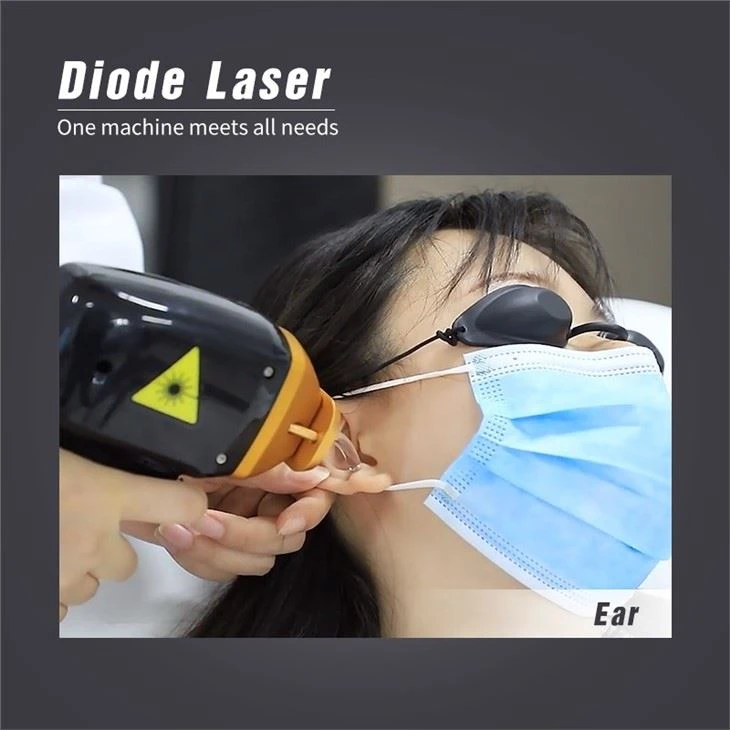 Permanent 808nm Diode Laser Soprano Titanium Hair Removal Machine