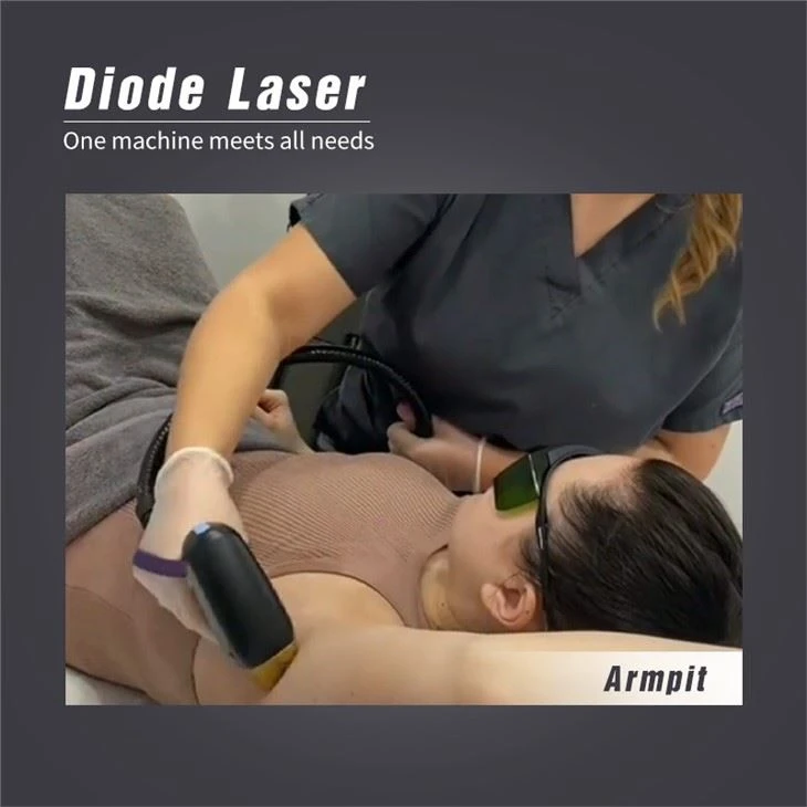 Permanent 808nm Diode Laser Soprano Titanium Hair Removal Machine