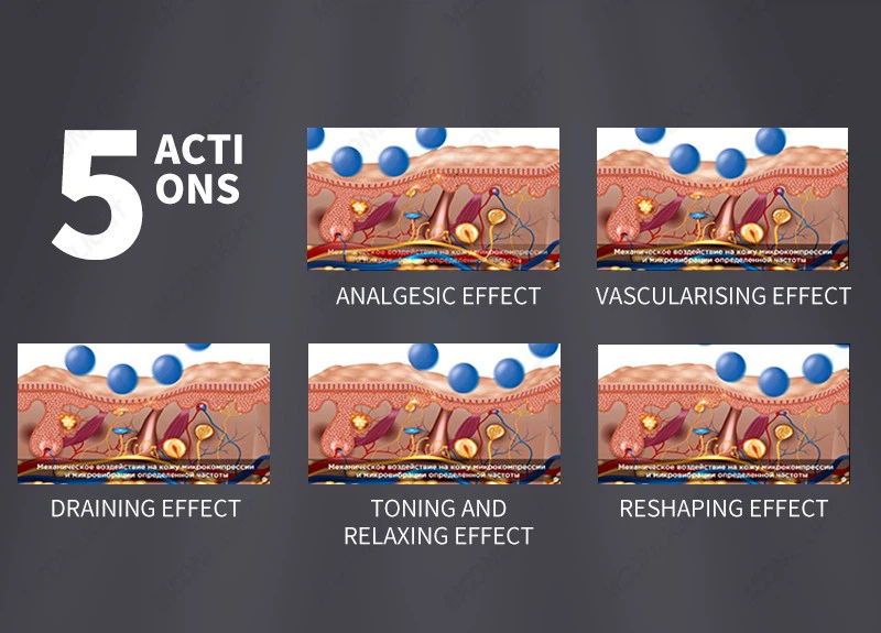 How Does The Endosphere Therapy Machine Work?