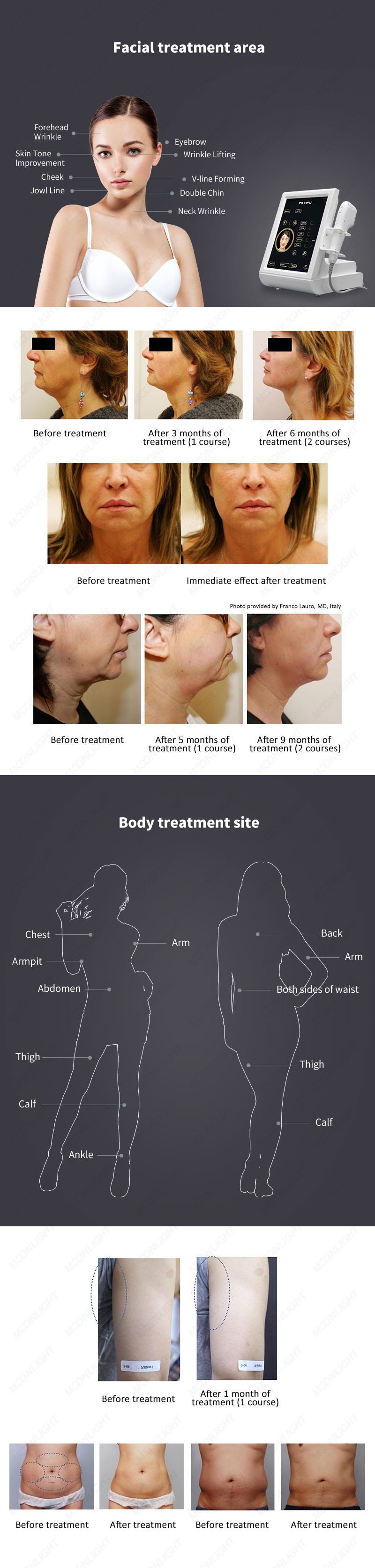Facial-effects03