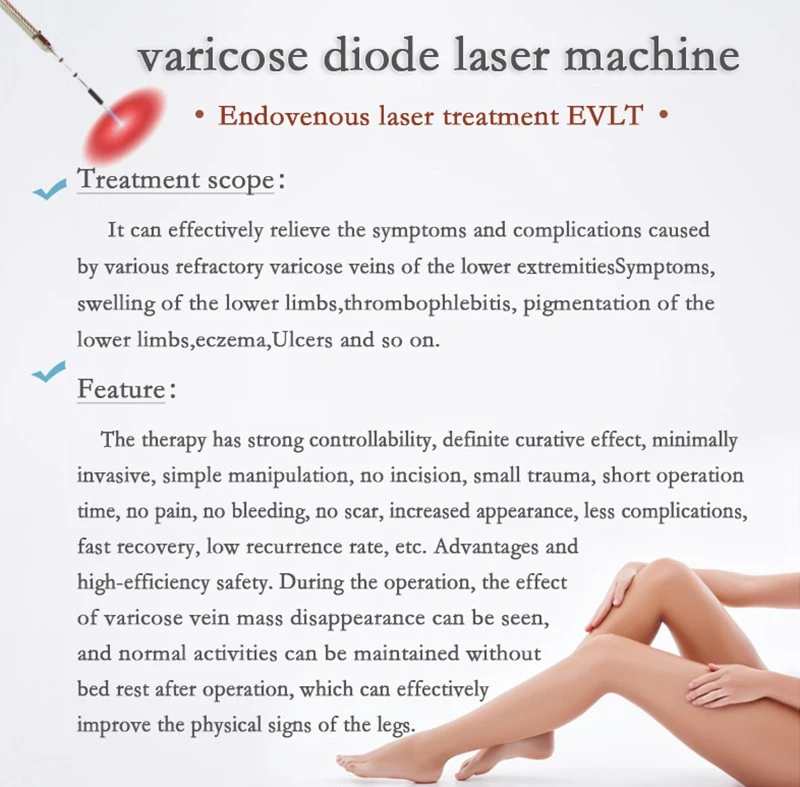 varicose-vein-diode varicose-vein-diode