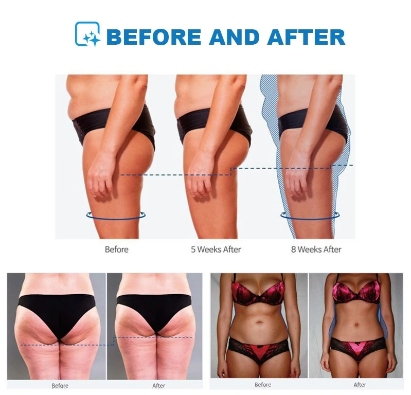 Vertical Ems Body Sculpt Machine
